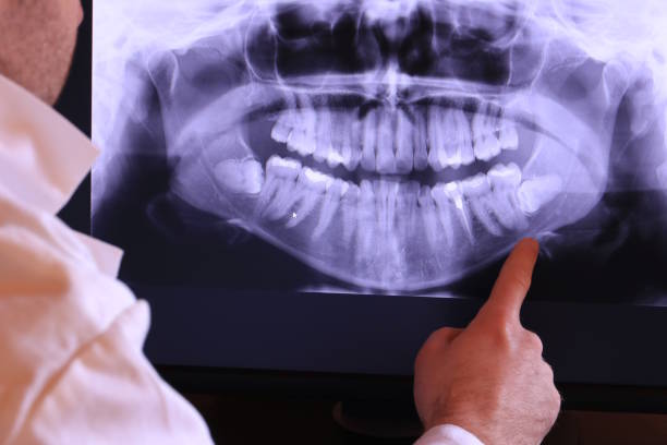 Best Root Canal Emergency Dentist  in Mill Valley, CA