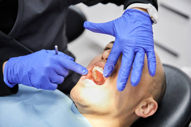 Best Knocked-Out Tooth Emergency  in Mill Valley, CA