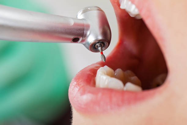 Best Tooth Pain Emergency Relief  in Mill Valley, CA